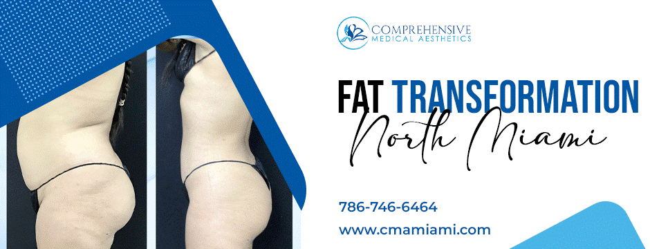 Fat Transformation in North Miami