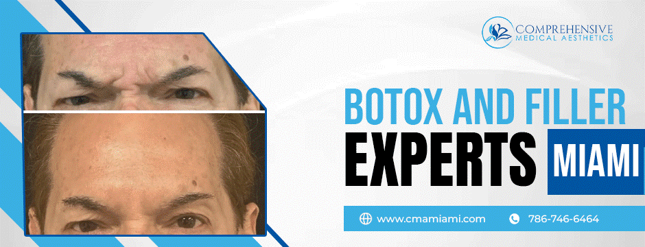 botox, and filler experts in Miami