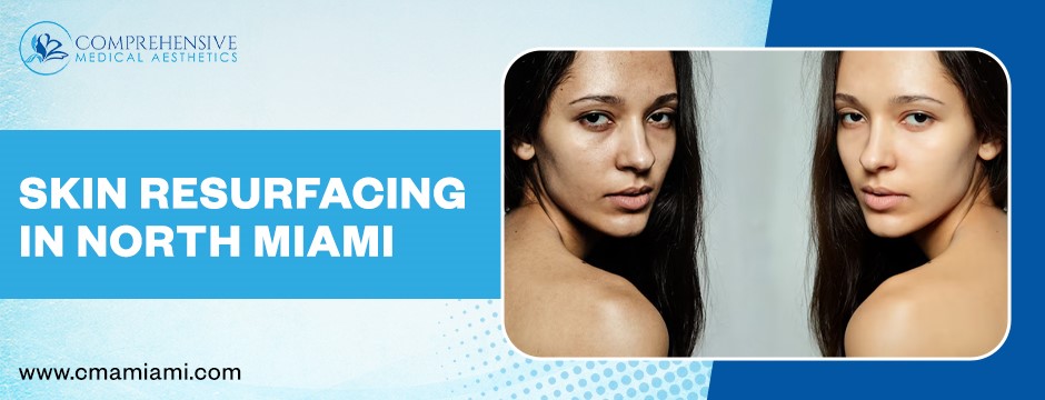 Skin Resurfacing in North Miami