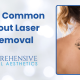 Debunking Common Myths About Laser Tattoo Removal