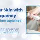 Tighten Your Skin with Radiofrequency - Alma Accent Prime Explained