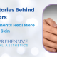 The Hidden Stories Behind Scars How Laser Treatments Heal More Than Skin