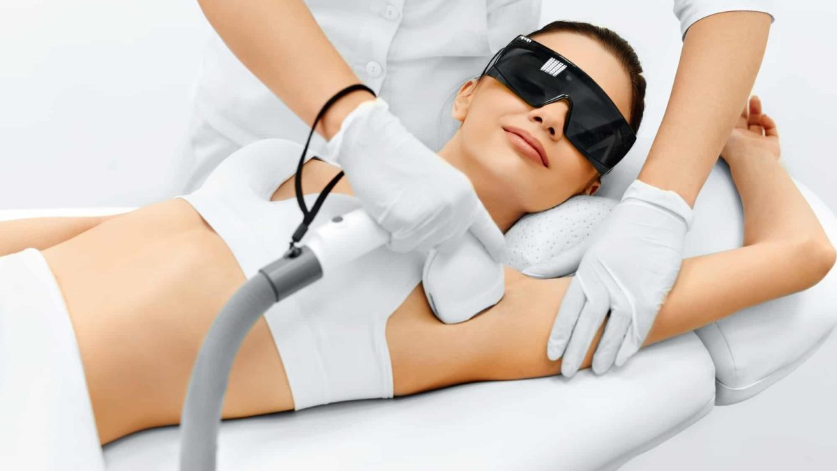 laser hair removal