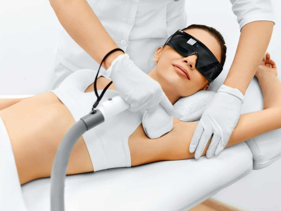 laser hair removal